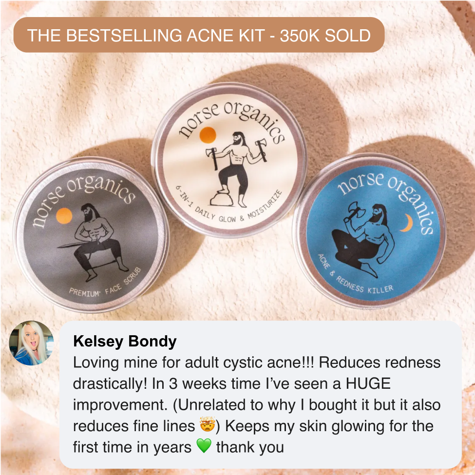 Three Acne Stopper Starter Pack jars with a bestseller badge and a customer testimonial