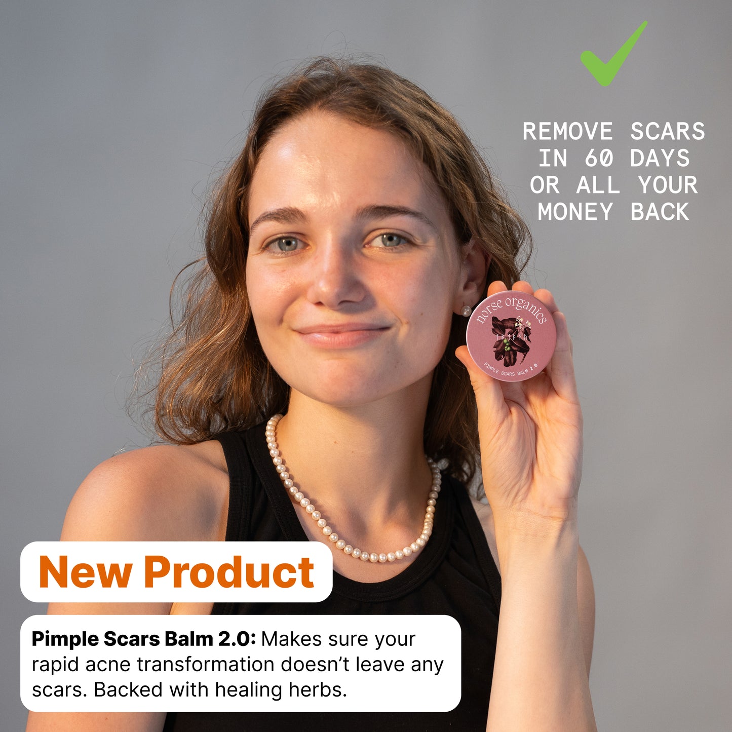 Woman holding Pimple Scars Balm 2.0 tin beside a 60-day money-back guarantee message for acne scars