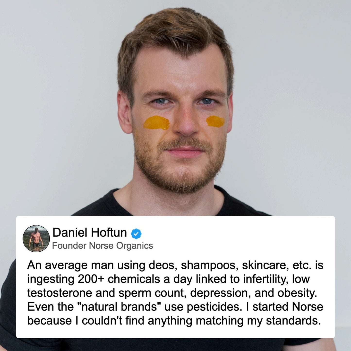 Norse Organics founder with Pimple Scars Balm 2.0 on his cheeks beside a natural skincare quote