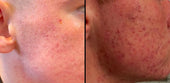 Copy of Before After #DQZ9QTRM