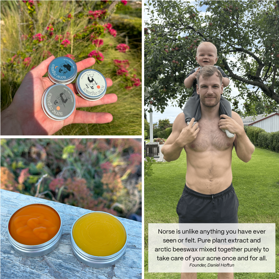 Lifestyle collage of Acne Stopper Starter Pack jars, open balms and the founder outdoors with a quote