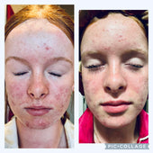 Copy of Before After #DQZ9QTRM
