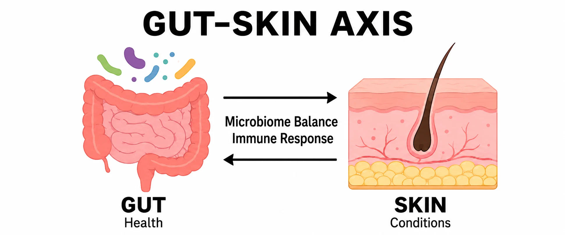 Gut-skin axis infographic showing how digestion affects acne