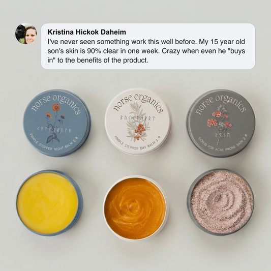 Three open Acne Stopper Starter Pack jars — night balm, day balm and scrub — with a customer testimonial