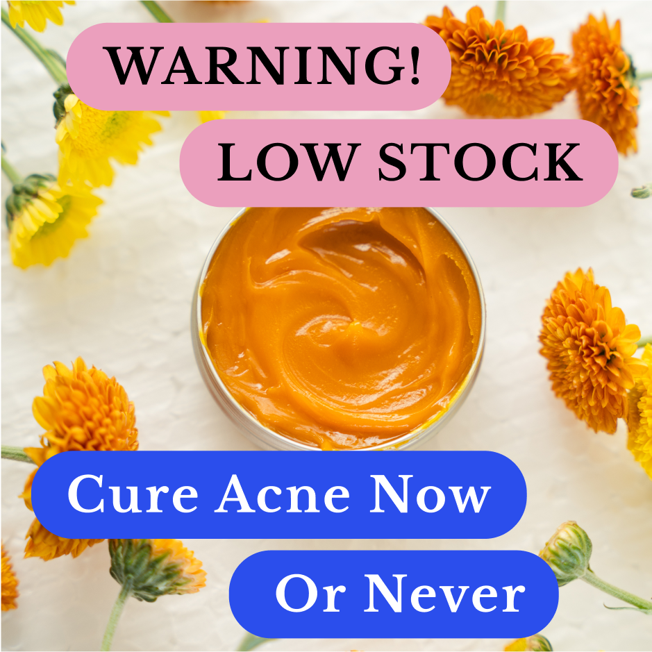 Open Acne Stopper Starter Pack day balm among marigold flowers with a low-stock promo graphic