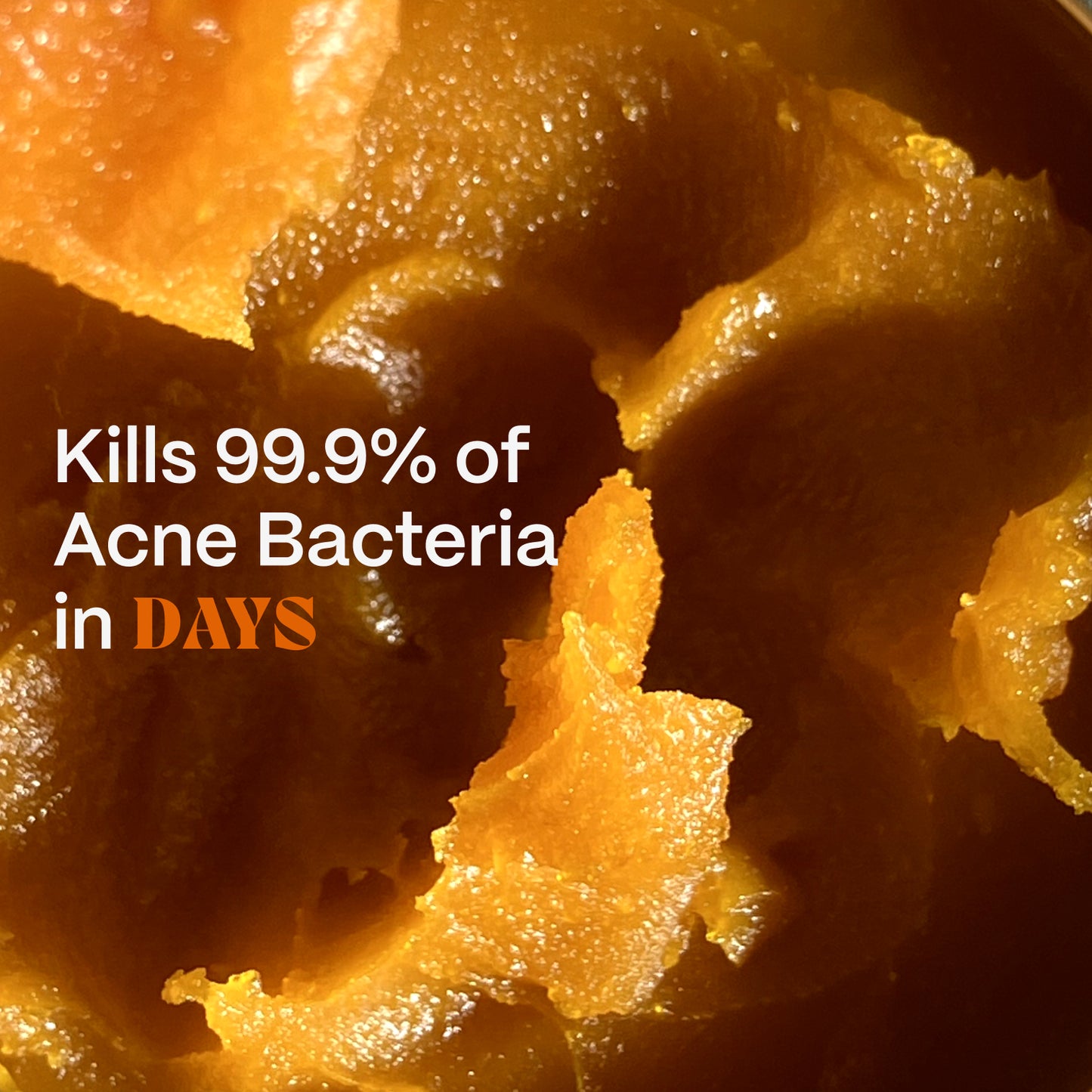 Close-up of golden Acne Killer balm texture with an on-pack acne-bacteria claim graphic