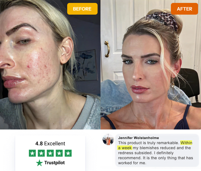 Norse Organics before and after results