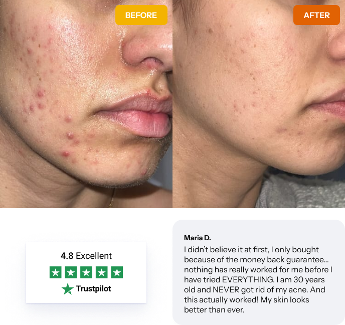 Before-and-after customer photos with a 4.8 Trustpilot rating showing clearer skin